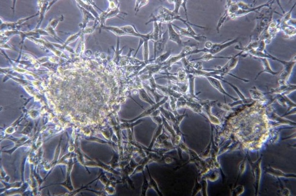 真菌毒素 真菌毒素